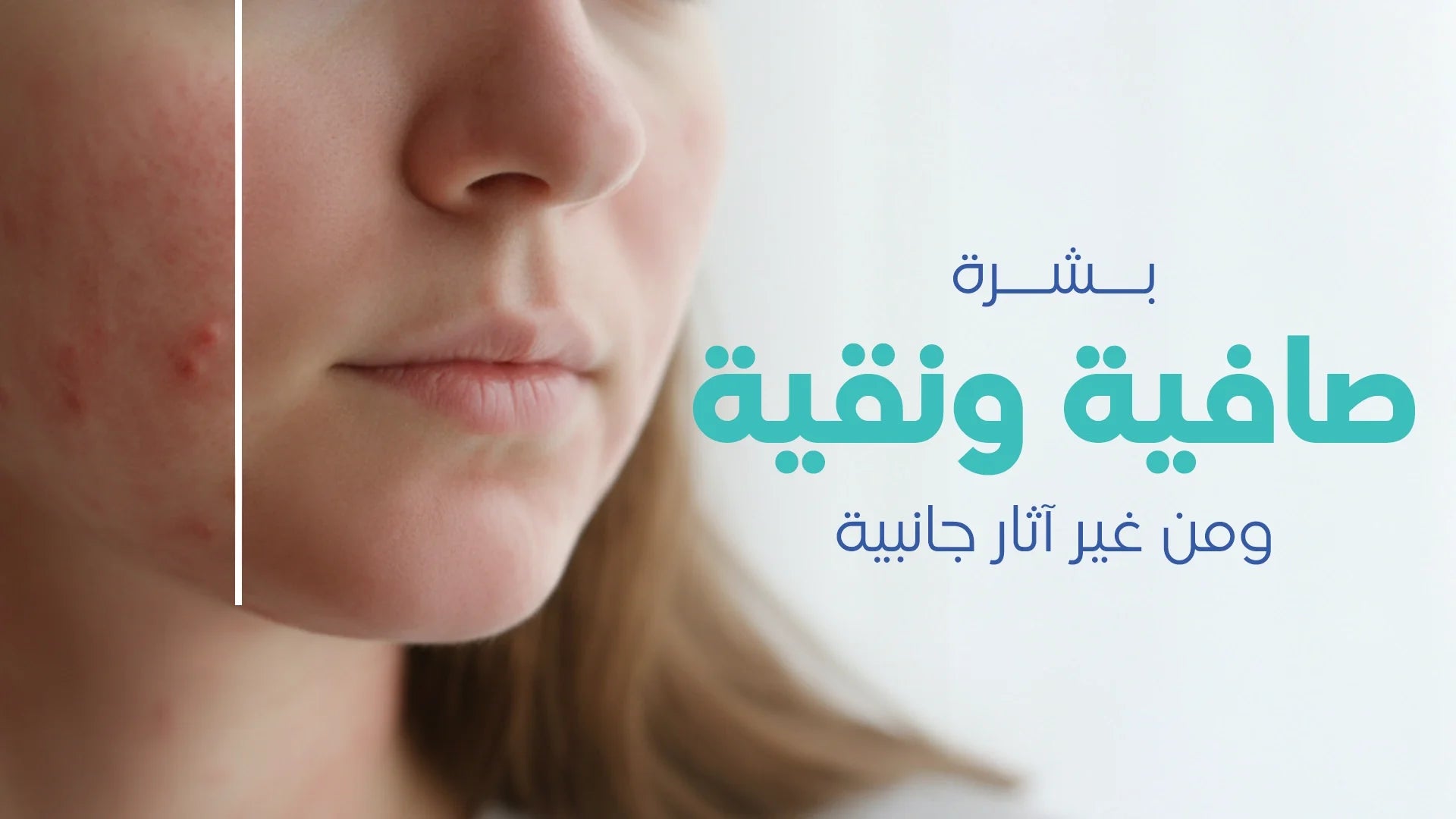 مجموعات علاج البشرة